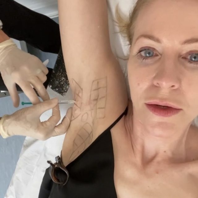 Woman having armpit injected with toxin
