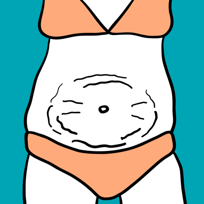Wrinkly Tummy - The Tweakments Guide